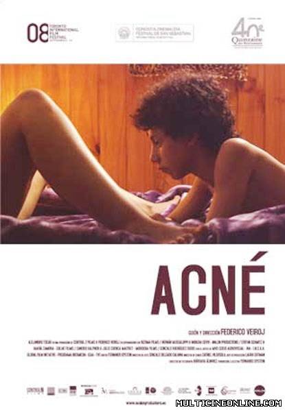 Ver Acné (2008) Online Gratis